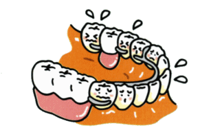 従来の治療：歯が数本抜けた場合